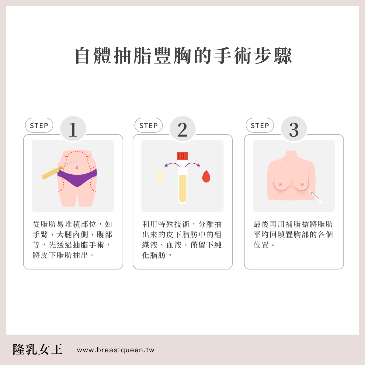 自體抽脂豐胸的手術步驟