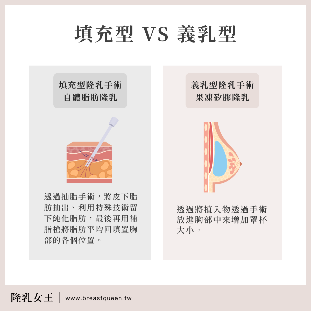 隆乳手術可簡單分為以下2大類