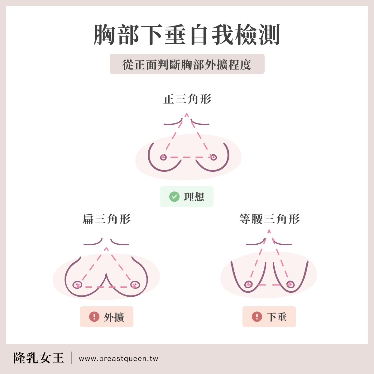 胸部下垂自我檢測