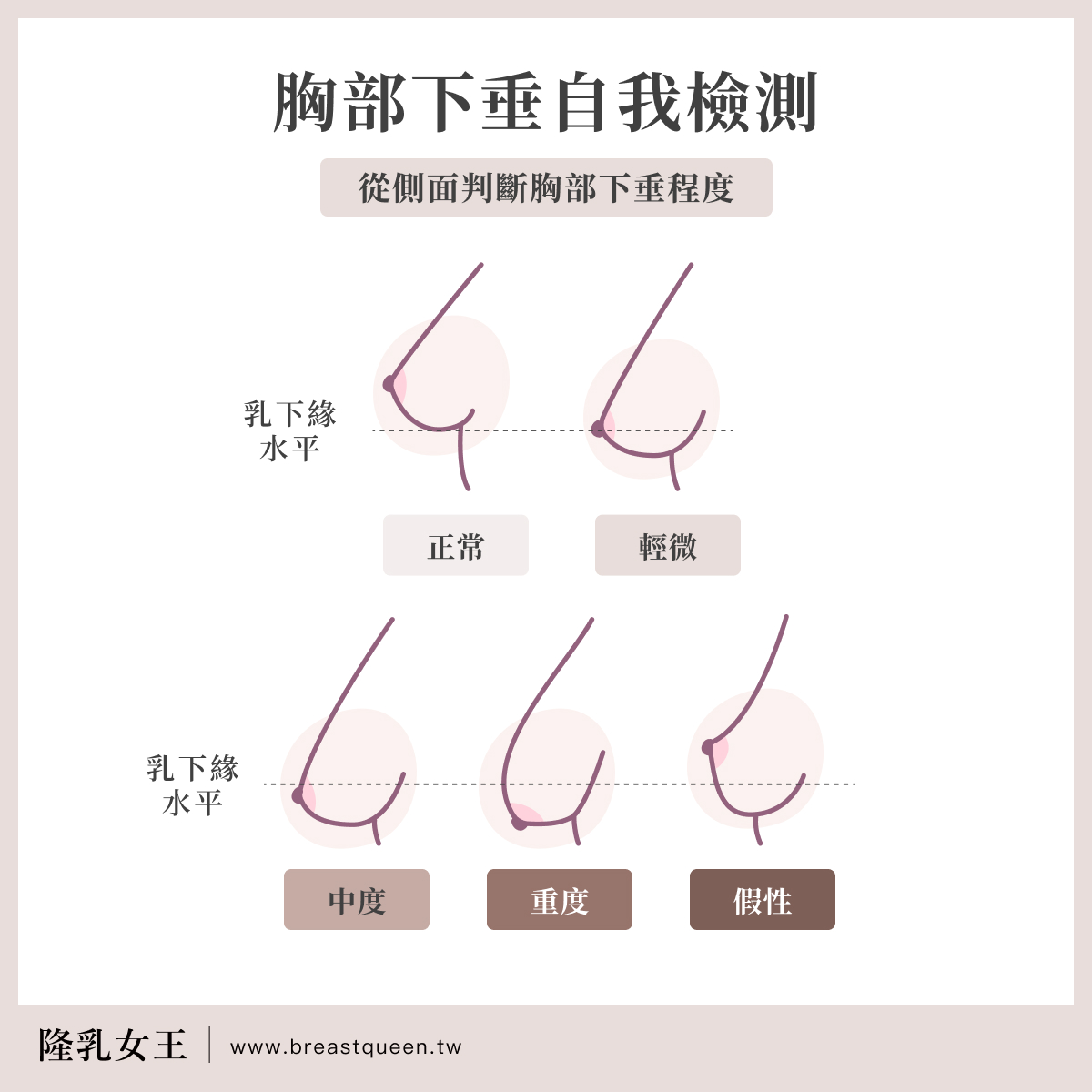 胸部下垂自我檢測